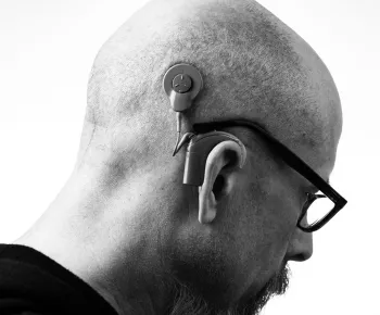 Baha 7 de Cochlear remboursé : une bonne nouvelle